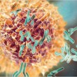 Lymphoma-1Non-Hodgkin- Lymphoma-1Non-Hodgkin-